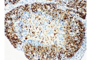Immunohistochemistry (IHC) image for anti-Hydroxysteroid (17-Beta) Dehydrogenase 1 (HSD17B1) (AA 29-43) antibody (ABIN3031269)