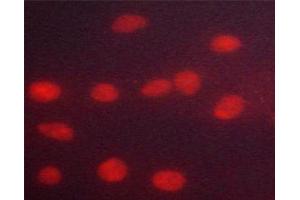 ABIN6267318 staining HeLa cells by ICC/IF. (Progesterone Receptor 抗体  (pSer294))