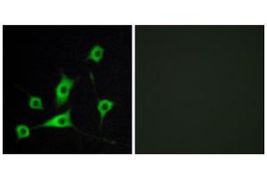 Immunofluorescence analysis of LOVO cells, using CRBP III antibody. (Retinol Binding Protein 5 抗体  (N-Term))