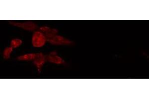 Immunofluorescence (fixed cells) (IF/ICC) image for anti-Junction Mediating and Regulatory Protein, P53 Cofactor (JMY) (C-Term) antibody (ABIN6262708)