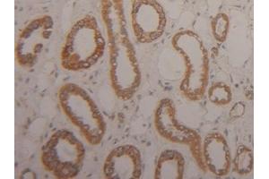 Detection of Arg2 in Human Kidney Tissue using Polyclonal Antibody to Arginase II (Arg2) (ARG2 抗体  (AA 23-354))
