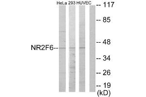 Western Blotting (WB) image for anti-Nuclear Receptor Subfamily 2, Group F, Member 6 (NR2F6) (N-Term) antibody (ABIN1849146) (NR2F6 抗体  (N-Term))