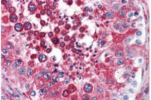 Human Testis (formalin-fixed, paraffin-embedded) stained with RTN4 antibody ABIN343914 at 3 ug/ml followed by biotinylated goat anti-rabbit IgG secondary antibody ABIN481713, alkaline phosphatase-streptavidin and chromogen. (Reticulon 4 抗体  (N-Term))