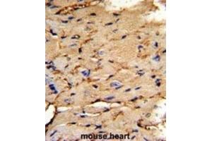 Immunohistochemistry (IHC) image for anti-phosphoprotein Enriched in Astrocytes 15 (PEA15) antibody (ABIN3003786) (PEA15 抗体)