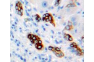 Used in DAB staining on fromalin fixed paraffin-embedded liver tissue (CA9 抗体  (AA 59-414))