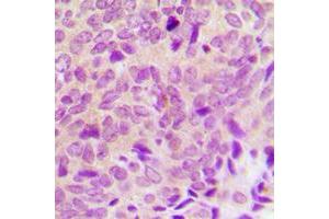 Immunohistochemistry (IHC) image for anti-Protein tyrosine Phosphatase, Non-Receptor Type 1 (PTPN1) (N-Term) antibody (ABIN7301178)