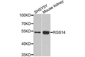 Western blot analysis of extracts of various cell lines, using RGS14 antibody. (RGS14 抗体)