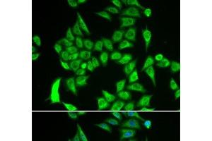 Immunofluorescence analysis of A549 cells using IREB2 Polyclonal Antibody (IREB2 抗体)