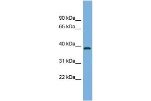 WB Suggested Anti-FBP2 Antibody Titration:  0. (FBP2 抗体  (Middle Region))