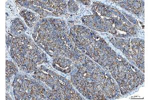 IHC analysis of Poliovirus Receptor/PVR using anti-Poliovirus Receptor/PVR antibody (ABIN7601072). (Poliovirus Receptor 抗体  (AA 28-331))