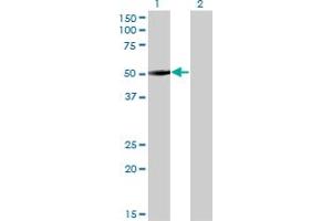 Western Blot analysis of ZNF213 expression in transfected 293T cell line by ZNF213 monoclonal antibody (M01), clone 5D7. (ZNF213 抗体  (AA 133-242))