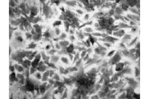 Imunohistochemical analysis of rat brain astrocyte, using Slc22a3 polyclonal antibody  . (SLC22A3 抗体)