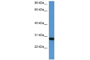 WB Suggested Anti-Hoxb1 Antibody Titration:  0. (HOXB1 抗体  (C-Term))