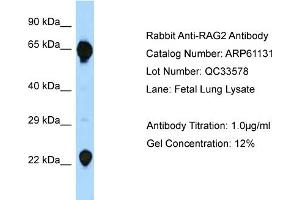 Western Blotting (WB) image for anti-Recombination Activating Gene 2 (RAG2) (C-Term) antibody (ABIN2788687) (RAG2 抗体  (C-Term))