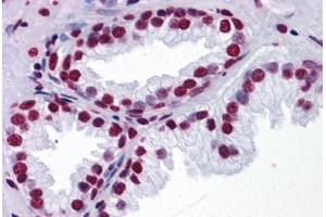 Human Prostate: Formalin-Fixed, Paraffin-Embedded (FFPE) (THOC6 抗体  (AA 71-181))