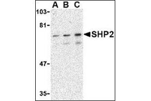 Western blot analysis of SHP2 in mouse skeletal muscle tissue lysate with this product at (A) 0. (PTPN11 抗体  (C-Term))
