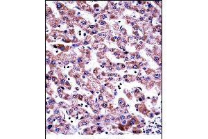 GDI2 Antibody (Center) ((ABIN657709 and ABIN2846700))immunohistochemistry analysis in formalin fixed and paraffin embedded human liver tissue followed by peroxidase conjugation of the secondary antibody and DAB staining. (GDI2 抗体  (AA 135-164))
