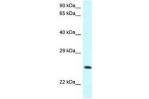 Image no. 1 for anti-WW Domain Containing Oxidoreductase (WWOX) (AA 95-144) antibody (ABIN6747534) (WWOX 抗体  (AA 95-144))