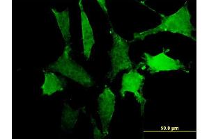 Immunofluorescence of monoclonal antibody to SIRPA on NIH/3T3 cell. (SIRPA 抗体  (AA 28-507))