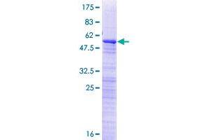 RP9 Protein (AA 1-221) (GST tag)