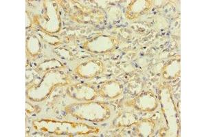 Immunohistochemistry of paraffin-embedded human kidney tissue using ABIN7170187 at dilution of 1:100 (SLC25A35 抗体  (AA 120-168))