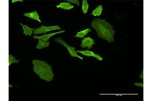 Immunofluorescence of monoclonal antibody to DHRS9 on HeLa cell. (DHRS9 抗体  (AA 1-319))