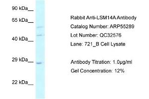 WB Suggested Anti-LSM14A Antibody Titration: 0. (LSM14A 抗体  (C-Term))