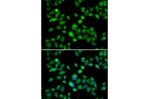 Immunofluorescence analysis of U2OS cells using MBTPS1 antibody. (MBTPS1 抗体)