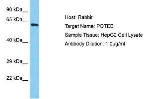 Host: Rabbit Target Name: POTEB Sample Type: HepG2 Whole Cell lysates Antibody Dilution: 1. (POTEB 抗体  (C-Term))