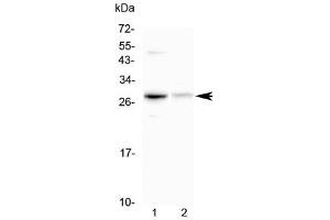 Western blot testing of 1) mouse HEPA1-6 and 2) rat kidney lysate with Oncostatin M antibody at 0. (Oncostatin M 抗体)