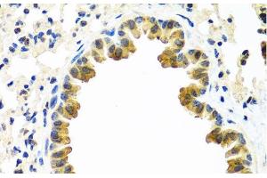 Immunohistochemistry of paraffin-embedded Mouse lung using CRTAP Polyclonal Antibody at dilution of 1:100 (40x lens). (CRTAP 抗体)