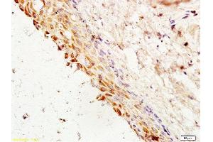 Immunohistochemistry (Paraffin-embedded Sections) (IHC (p)) image for anti-Cyclin G1 (CCNG1) (AA 181-295) antibody (ABIN685837)