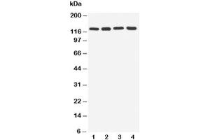 Western blot testing of TLR7 antibody and Lane 1:  rat spleen (TLR7 抗体  (C-Term))