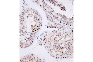 Immunohistochemical analysis of (ABIN1539554 and ABIN2849696) on paraffin-embedded human testis tissue was performed on the Leica®BOND RXm. (OTUD7A 抗体  (N-Term))