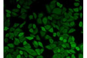 Detection of PGK1 in Hela cells using Polyclonal Antibody to Phosphoglycerate Kinase 1 (PGK1) (PGK1 抗体  (AA 2-417))