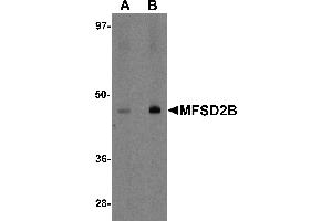 Western blot analysis of MFSD2B in rat lung tissue lysate with MFSD2B antibody at (A) 1 and (B) 2 µg/mL. (MFSD2B 抗体  (Middle Region))