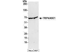 anti-Thyroid Hormone Receptor Interactor 4 (TRIP4) (AA 75-125) antibody