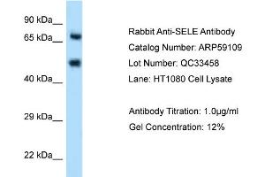 WB Suggested Anti-SELE Antibody Titration: 0. (Selectin E/CD62e 抗体  (N-Term))