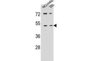 Western Blotting (WB) image for anti-Protease, Serine, 55 (PRSS55) antibody (ABIN2996346) (PRSS55 抗体)