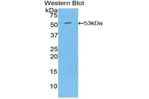 Detection of Recombinant IL6, Human using Polyclonal Antibody to Interleukin 6 (IL6) (IL-6 抗体  (AA 29-212))