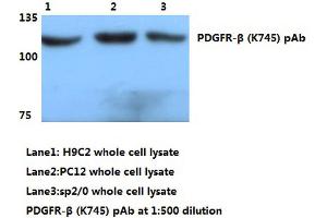 Western blot (WB) analyzes of PDGFR-β antibody (PDGFRB 抗体)