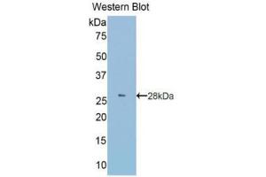 Western Blotting (WB) image for anti-Granulin (GRN) (AA 234-419) antibody (ABIN1859076) (Granulin 抗体  (AA 234-419))