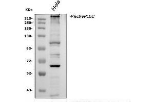 Western blot analysis of Plectin using anti-Plectin antibody (ABIN3043900).