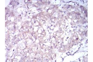 Immunohistochemistry (IHC) image for anti-Neurotrophic Tyrosine Kinase, Receptor, Type 2 (NTRK2) (AA 207-339) antibody (ABIN5542348)