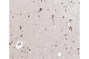 ABIN6266648 at 1/100 staining human brain tissue sections by IHC-P. (CDK7 抗体  (Internal Region))