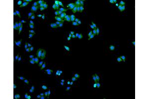 Immunofluorescence analysis of HepG2 cells using SLC2A1 antibody (ABIN5997113). (GLUT1 抗体)