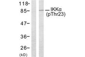Western blot analysis of extracts from MDA-MB-435 cells treated with EGF, using IKK-alpha (Phospho-Thr23) Antibody. (IKK alpha 抗体  (pThr23))