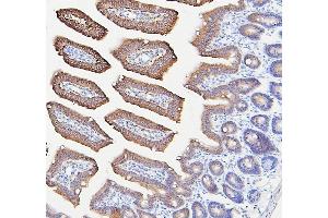 IHC analysis of IFNAR2 using anti-IFNAR2 antibody (ABIN7601353).
