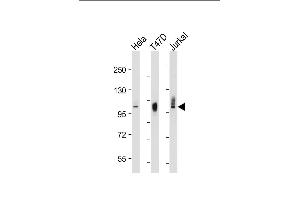 All lanes : Anti-LP2 Antibody at 1:2000-8000 dilution Lane 1: HeLat whole cell lysate Lane 2: T47D whole cell lysate Lane 3: Jurkat whole cell lysate Lysates/proteins at 20 μg per lane. (LAMP2 抗体)
