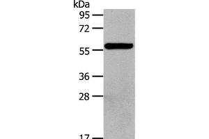 Western Blot analysis of Hela cell using HDAC7 Polyclonal Antibody at dilution of 1:100 (HDAC7 抗体)